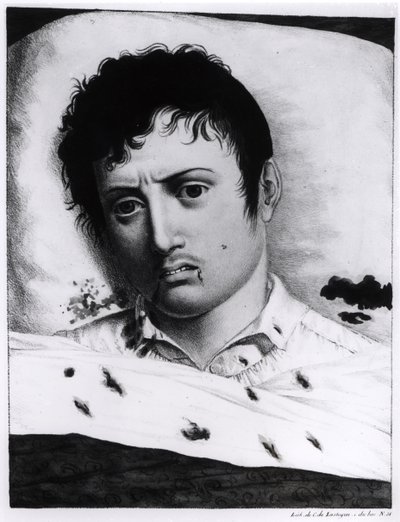 Observation de la fièvre jaune, c.1819 - Charles Lasteyrie du Saillant